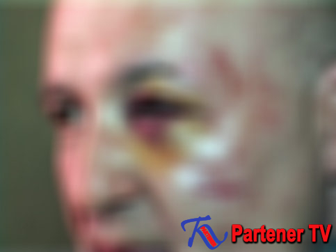 CORBII MARI: Localnic bătut de un consilier al actualului primar