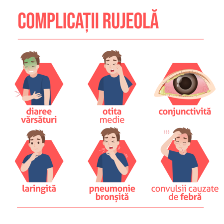 Alertă medicală, în ultimele zile, autoritățile de sănătate publică din România au semnalat o creștere alarmantă a cazurilor de rujeolă,